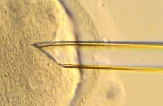 8 Wholesome ‘Three-Mother or father’ Infants Born in UK Utilizing Pioneering IVF Method